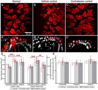 Partial Aminoglycoside Lesions in Vestibular Epithelia Reveal Broad Sensory Dysfunction Associated with Modest Hair Cell Loss and Afferent Calyx Retraction